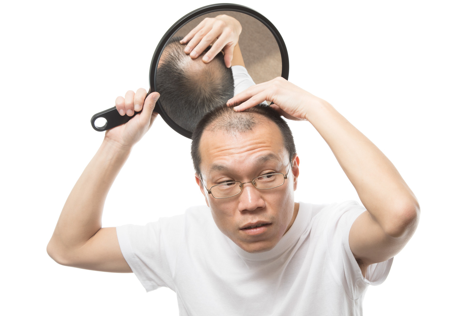 【体験談】円形脱毛症は範囲が広がる症状が多い！原因とは？｜抜け毛や薄毛、白髪や頭皮トラブルなど男性女性の髪の悩みを解決
